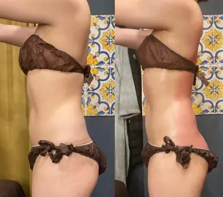 小顔やたるみに特化 💚野瀬可蓮のその他イメージ