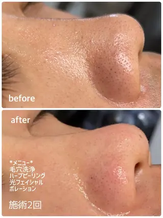 LAESSE 恵比寿所属・毛穴と美白の専門店 LAESSE 恵比寿のエステ・リラクイメージ