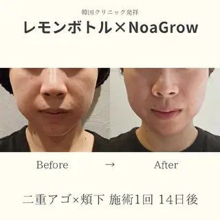 痩身小顔専門 アマテ ビューティー.Nのエステ・リラクイメージ