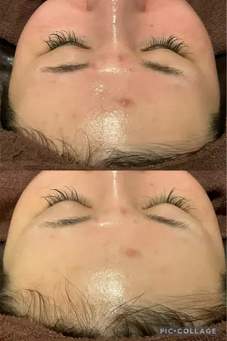 ニキビケア専門サロン Unityのエステ・リラクイメージ