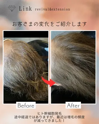 美容と育毛のサロン Link　松浦のマツエク・マツパデザイン
