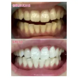 M渋谷 ホワイトニングのエステ・リラクイメージ