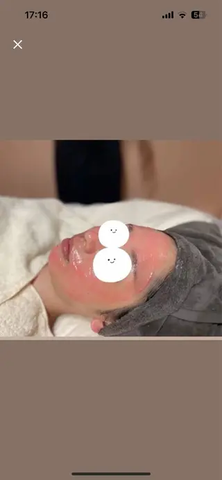 Ultimate 指名なしのエステ・リラクイメージ