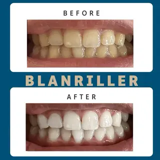 BLANRILLER所属・ホワイトニングサロン ブランリエ阿倍野店のその他イメージ