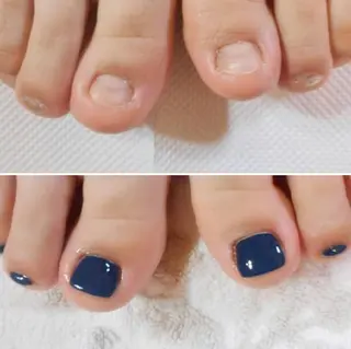 ネイル ネイルサロン アリュームのネイルデザイン