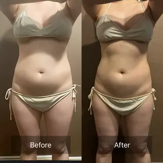 腸活/クビレを作る /痩身エステのエステ・リラクイメージ