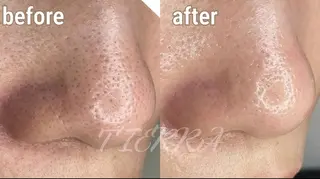 TIERRA(ティエラ)所属・TIERRA ♡のエステ・リラクイメージ