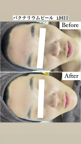 Be Charm 山﨑のエステ・リラクイメージ