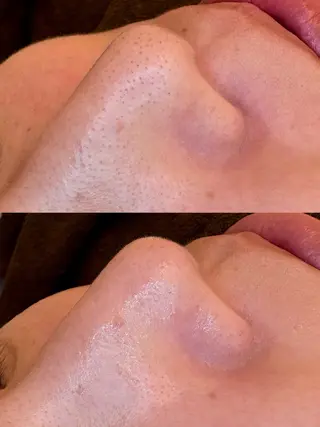 🤍アベシュリ /フェイシャル🤍のエステ・リラクイメージ