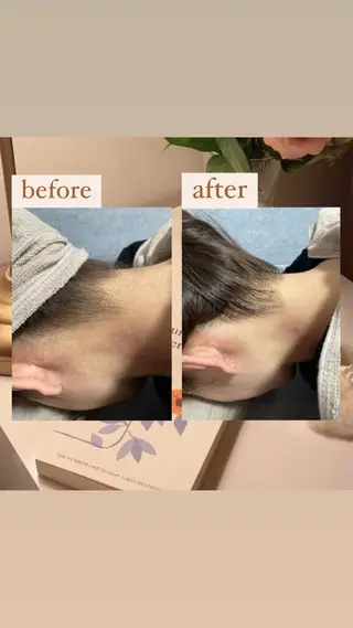 【韓国肌管理・脱毛】 クレセントのその他イメージ