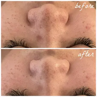 メンズ メナード岐阜市茜部 杉浦のエステ・リラクイメージ