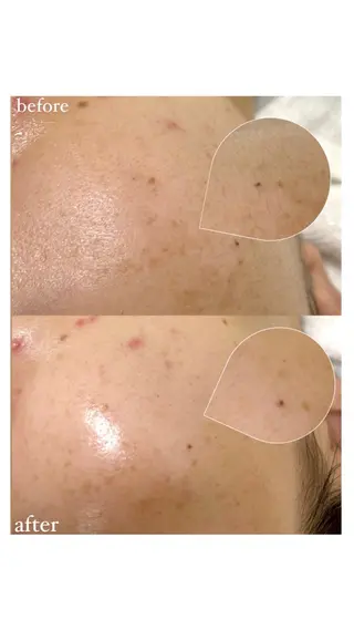 女性専門お顔剃り sunraineのエステ・リラクイメージ