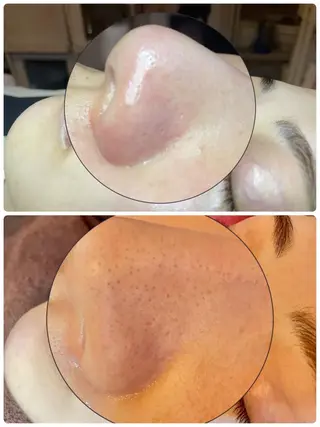 松下 千恵のネイルデザイン