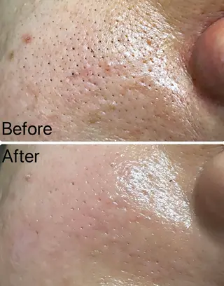 Belle原宿所属・佐藤 加奈のエステ・リラクイメージ