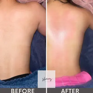 SHARES MADOKAのエステ・リラクイメージ