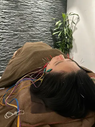 小顔矯/美容鍼/鍼灸 BeauJuのその他イメージ