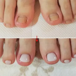 ネイル ネイルサロン アリュームのネイルデザイン