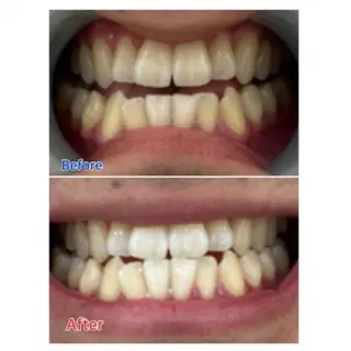 Ｍ渋谷 ホワイトニングのエステ・リラクイメージ