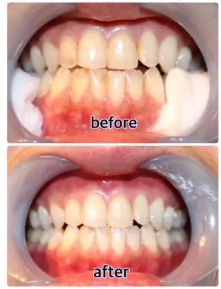 Nailbeauty marcherのネイルデザイン