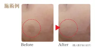 小顔とシミケア🪽 /Salon Mのエステ・リラクイメージ