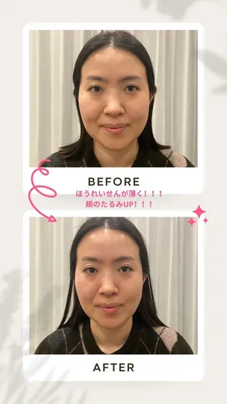 健康×美容鍼鍼灸院 あさば整体院三ノ輪店のエステ・リラクイメージ