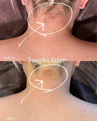 《学割》《脱毛》 LARUTANのエステ・リラクイメージ