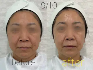 e-Reju イリュージュのネイルデザイン