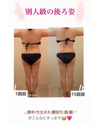 産後ダイエット−9㎏ Pourvous結衣のエステ・リラクイメージ