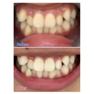 M渋谷 ホワイトニングのエステ・リラクイメージ