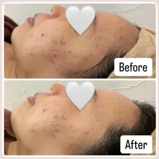 肌質改善sui所属・肌質改善 suiのエステ・リラクイメージ