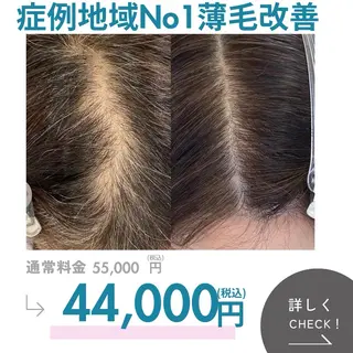 シミ・若返り特化 さゆみのエステ・リラクイメージ