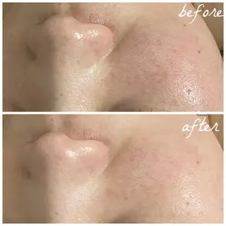 メンズ メナード岐阜茜部 杉浦のエステ・リラクイメージ