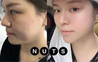 ネイル aliaハーブ水光店 エステティシャン募集のエステ・リラクイメージ