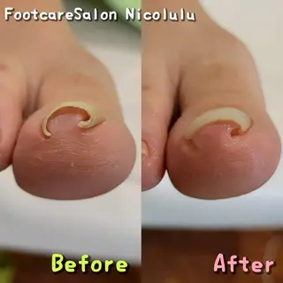 足トラブル専門 ニコルル金沢のエステ・リラクイメージ
