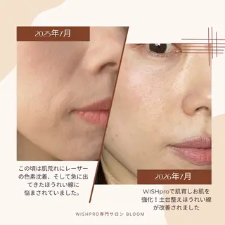 Total Beauty salon Bloom所属・脱毛専門 ページ/Bloomのエステ・リラクイメージ