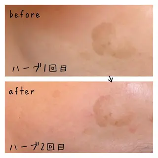 fairyrose organicエステのエステ・リラクイメージ