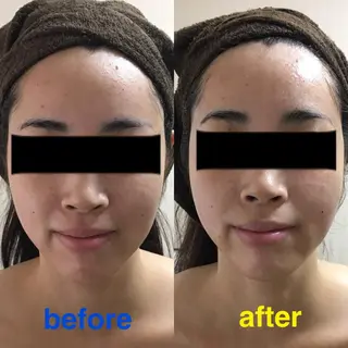 プライベートサロン soleilのエステ・リラクイメージ