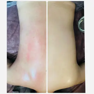 デトックス筋膜リンパ Charlotteのエステ・リラクイメージ