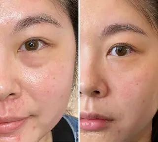 愛維美水光美肌専門店所属・愛維美水光美肌専門店 メンズレディースokのエステ・リラクイメージ