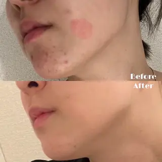 # fu♡のエステ・リラクイメージ