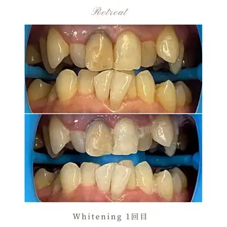 歯科医院提携 Retreatのエステ・リラクイメージ