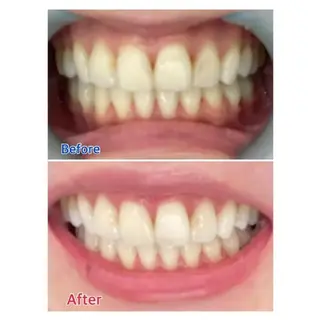 M渋谷 ホワイトニングのエステ・リラクイメージ