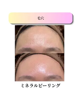 ローズフィールド 森岡朋美のエステ・リラクイメージ