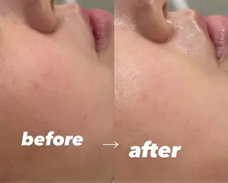 【vidyto】ヴィディトゥ所属・肌管理サロン vidyto　MOEのエステ・リラクイメージ