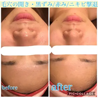 ロング カラー パーマ ヘアアレンジ キッズ ネイル マツエク・マツパ EnsorClair 代表 野口真央のエステ・リラクイメージ