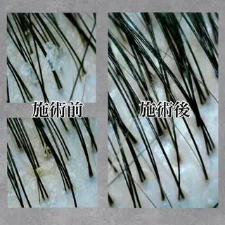 仙台ヘッドスパ/まど ろみ睡眠/中野凜香のヘアスタイル