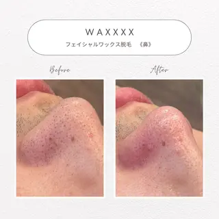 beaute LABO所属・大宮肌管理サロン sayakaのエステ・リラクイメージ