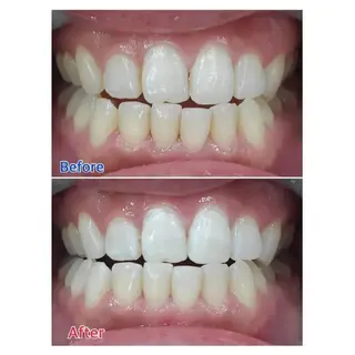 M渋谷 ホワイトニングのエステ・リラクイメージ