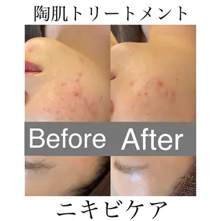 ルアナアイナ 大分のエステ・リラクイメージ