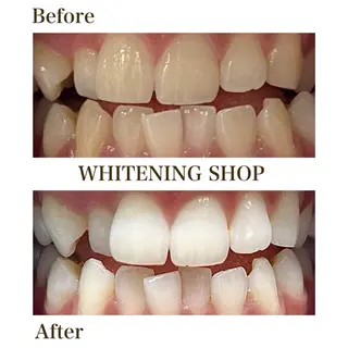 ホワイトニング ショップ銀座7丁目店のその他イメージ